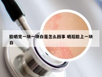 脸晒完一块一块白是怎么回事 晒后脸上一块白