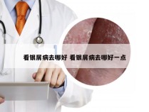 看银屑病去哪好 看银屑病去哪好一点