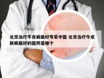 北京治疗牛皮癣最好专家中医 北京治疗牛皮肤癣最好的医院是哪个