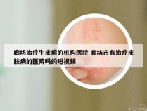 廊坊治疗牛皮癣的机构医院 廊坊市有治疗皮肤病的医院吗的短视频