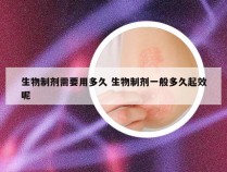 生物制剂需要用多久 生物制剂一般多久起效呢