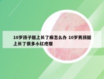 10岁孩子腿上长了癣怎么办 10岁男孩腿上长了很多小红疙瘩