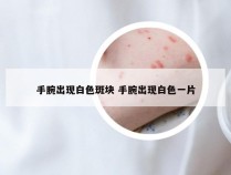 手腕出现白色斑块 手腕出现白色一片