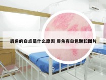 唇角的白点是什么原因 唇角有白色颗粒图片