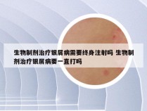 生物制剂治疗银屑病需要终身注射吗 生物制剂治疗银屑病要一直打吗