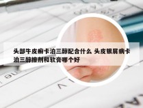头部牛皮癣卡泊三醇配合什么 头皮银屑病卡泊三醇擦剂和软膏哪个好