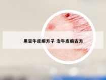 黑豆牛皮癣方子 治牛皮癣古方