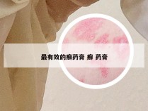 最有效的癣药膏 癣 药膏