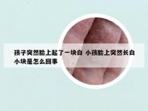 孩子突然脸上起了一块白 小孩脸上突然长白小块是怎么回事