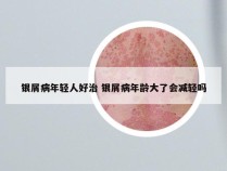 银屑病年轻人好治 银屑病年龄大了会减轻吗