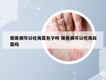 银屑病可以吃海菜包子吗 银屑病可以吃海白菜吗