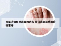 哈尔滨银屑病最好的大夫 哈尔滨银屑病治疗哪家好