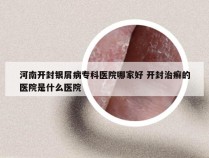 河南开封银屑病专科医院哪家好 开封治癣的医院是什么医院