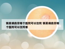 银屑病南京哪个医院可以住院 银屑病南京哪个医院可以住院看