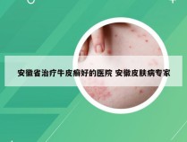 安徽省治疗牛皮癣好的医院 安徽皮肤病专家