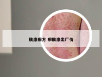 肤康癣方 癣肤康出厂价