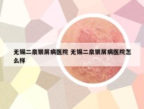 无锡二泉银屑病医院 无锡二泉银屑病医院怎么样