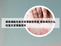 银屑病能吃复方甘草酸苷胶囊 银屑病为什么吃复方甘草酸苷片