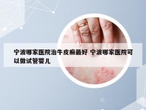 宁波哪家医院治牛皮癣最好 宁波哪家医院可以做试管婴儿