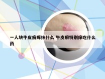 一人块牛皮癣痒抹什么 牛皮癣特别痒吃什么药