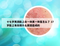 十七岁男孩脸上白一块黑一块是怎么了 17岁脸上有白斑什么原因造成的