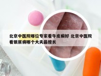 北京中医院哪位专家看牛皮癣好 北京中医院看银屑病哪个大夫最擅长
