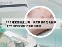 17个月宝宝脸蛋上有一块皮肤发白怎么回事 17个月的宝宝脸上有白色斑块