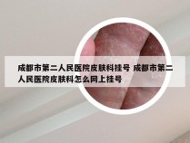 成都市第二人民医院皮肤科挂号 成都市第二人民医院皮肤科怎么网上挂号