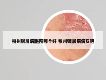 福州银屑病医院哪个好 福州银屑病病友吧