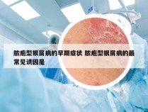 脓疱型银屑病的早期症状 脓疱型银屑病的最常见诱因是