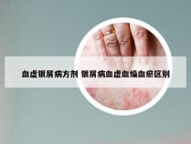 血虚银屑病方剂 银屑病血虚血燥血瘀区别