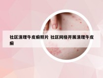 社区清理牛皮癣照片 社区网格开展清理牛皮癣