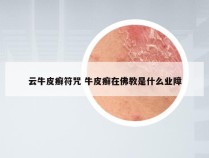 云牛皮癣符咒 牛皮癣在佛教是什么业障