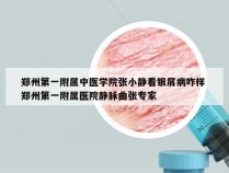 郑州第一附属中医学院张小静看银屑病咋样 郑州第一附属医院静脉曲张专家