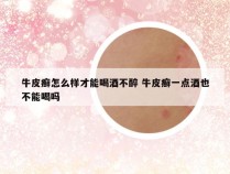 牛皮癣怎么样才能喝酒不醉 牛皮癣一点酒也不能喝吗