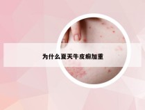 为什么夏天牛皮癣加重