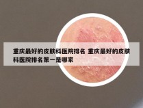 重庆最好的皮肤科医院排名 重庆最好的皮肤科医院排名第一是哪家