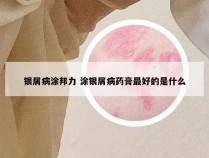 银屑病涂邦力 涂银屑病药膏最好的是什么
