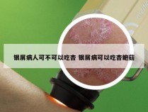 银屑病人可不可以吃杏 银屑病可以吃杏鲍菇