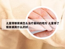 儿童得银屑病怎么治疗最好的地方 儿童得了银屑病用什么药好
