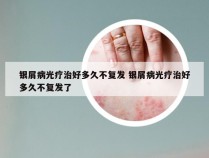 银屑病光疗治好多久不复发 银屑病光疗治好多久不复发了