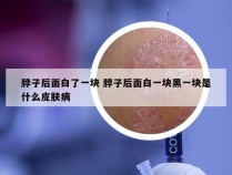 脖子后面白了一块 脖子后面白一块黑一块是什么皮肤病