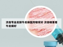 济南专业皮肤牛皮癣医院哪家好 济南哪里看牛皮癣好