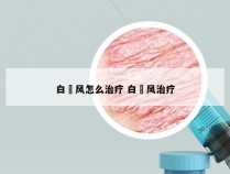 白瘨风怎么治疗 白痶风治疗