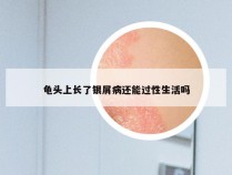 龟头上长了银屑病还能过性生活吗