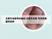 太原牛皮癣专科医院 太原牛皮屑 专家肤康医院官网