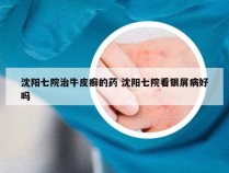 沈阳七院治牛皮癣的药 沈阳七院看银屑病好吗