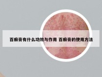 百癣膏有什么功效与作用 百癣膏的使用方法