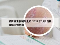 银屑病生物制剂上市 2021年3月1日银屑病生物制剂