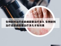 生物制剂治疗皮肤病需要治疗多久 生物制剂治疗皮肤病需要治疗多久才有效果
